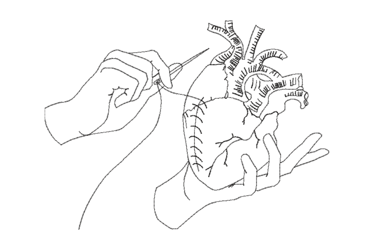 Anatomical Heart Sewing Machine Embroidery Design